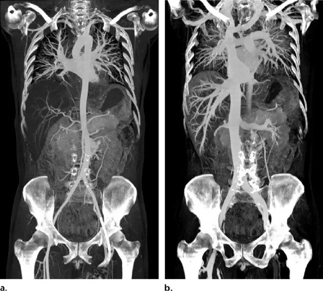 arterial and venous postmortem c