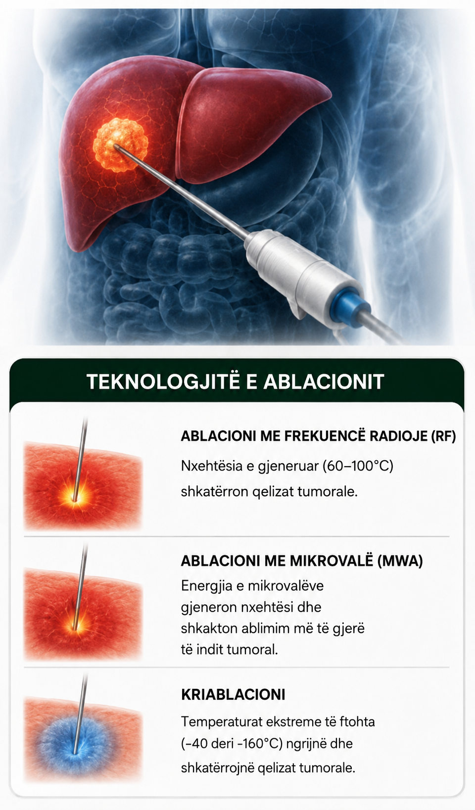 ablazion tumori