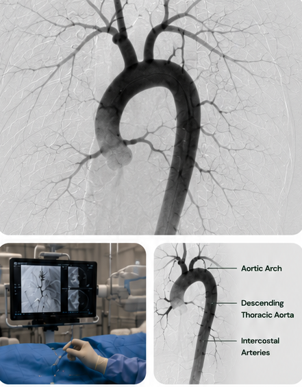 angiografi torakale