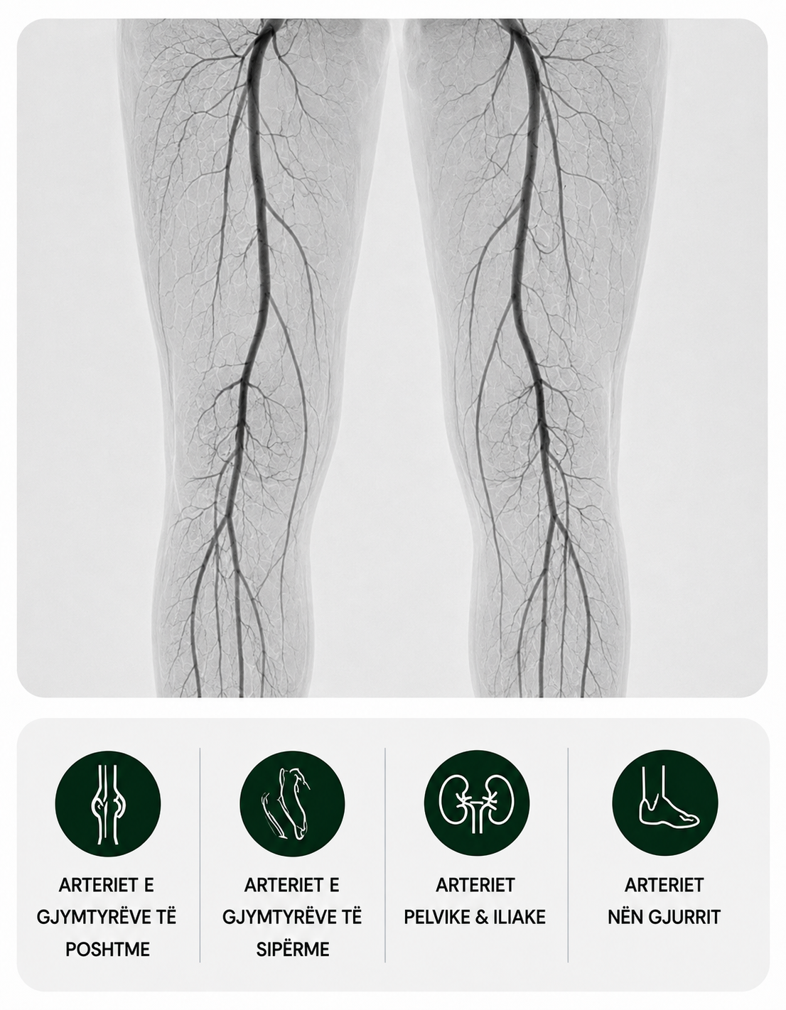 angiografia periferike (2)