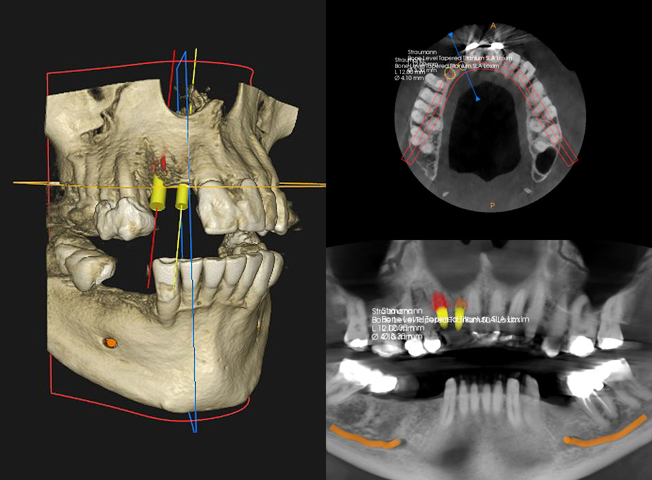 dental