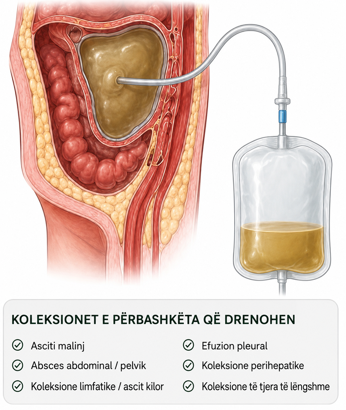 drenazhi koleksioneve malinje