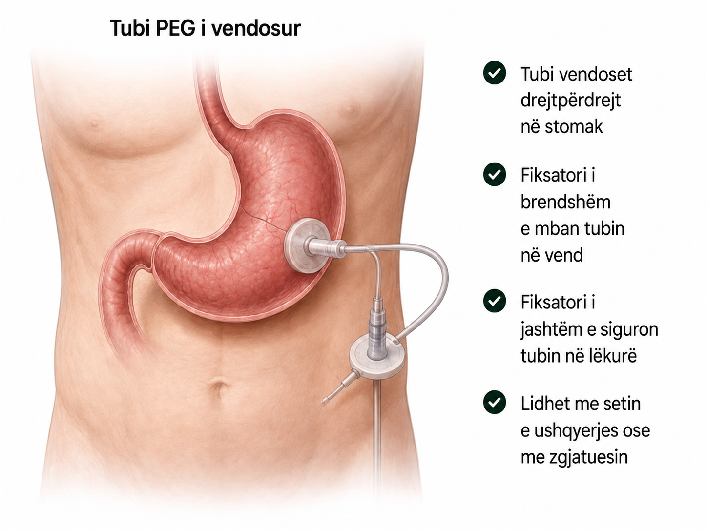 peg