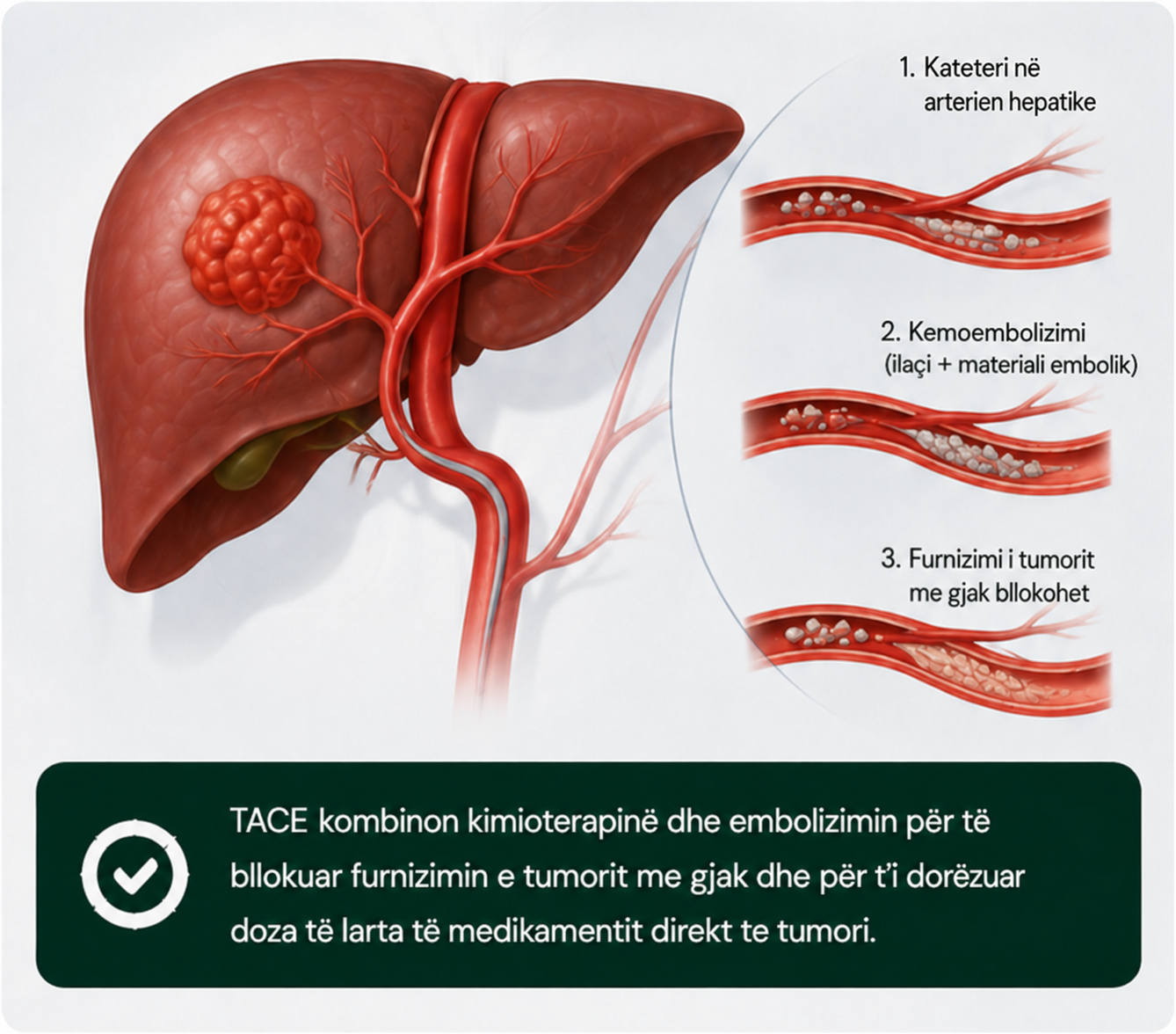 tace 1