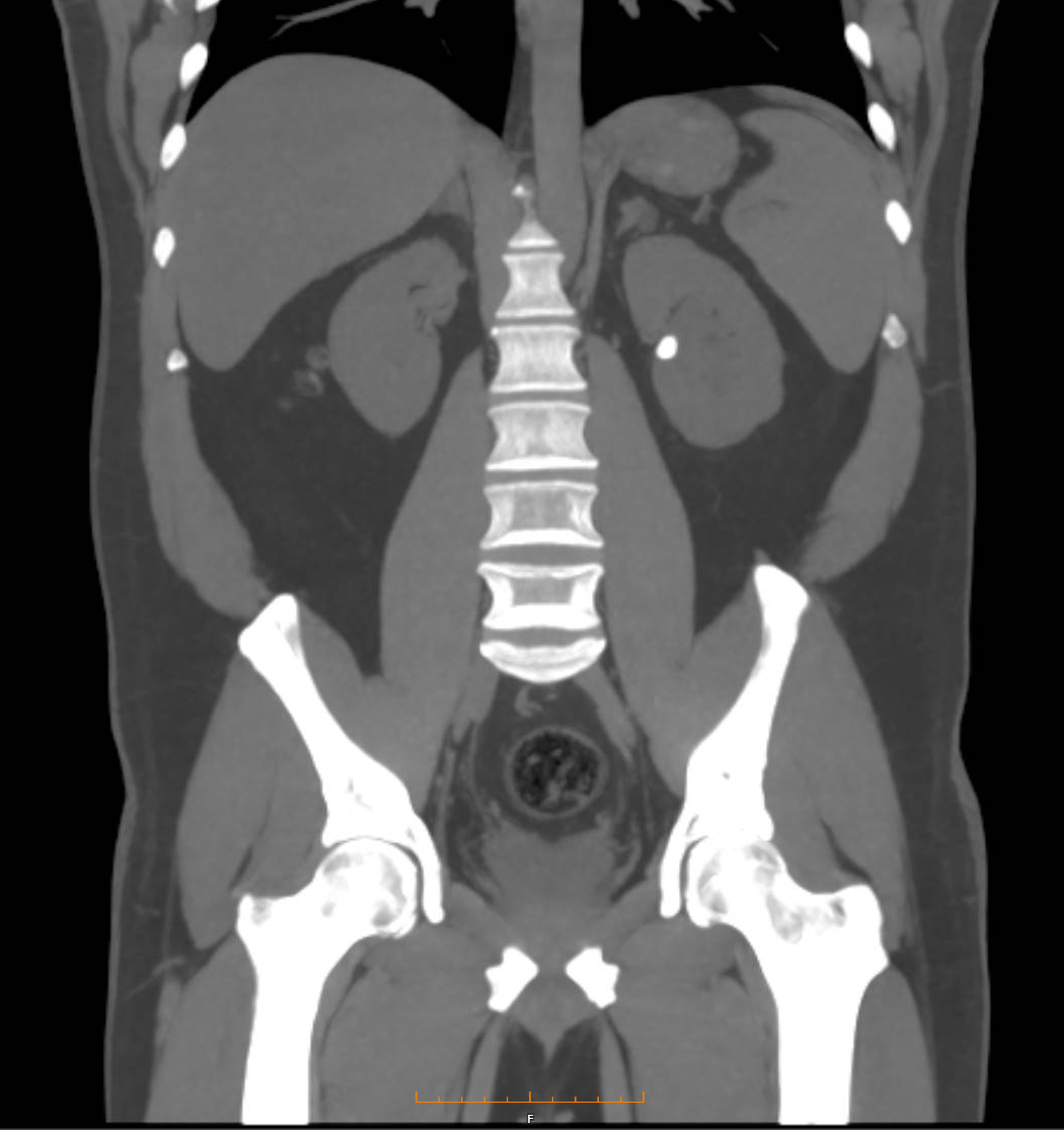 uroct