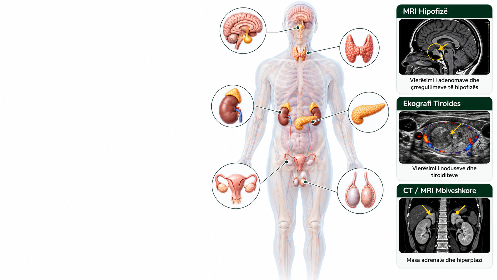 Çrregullime të tjera hormonale