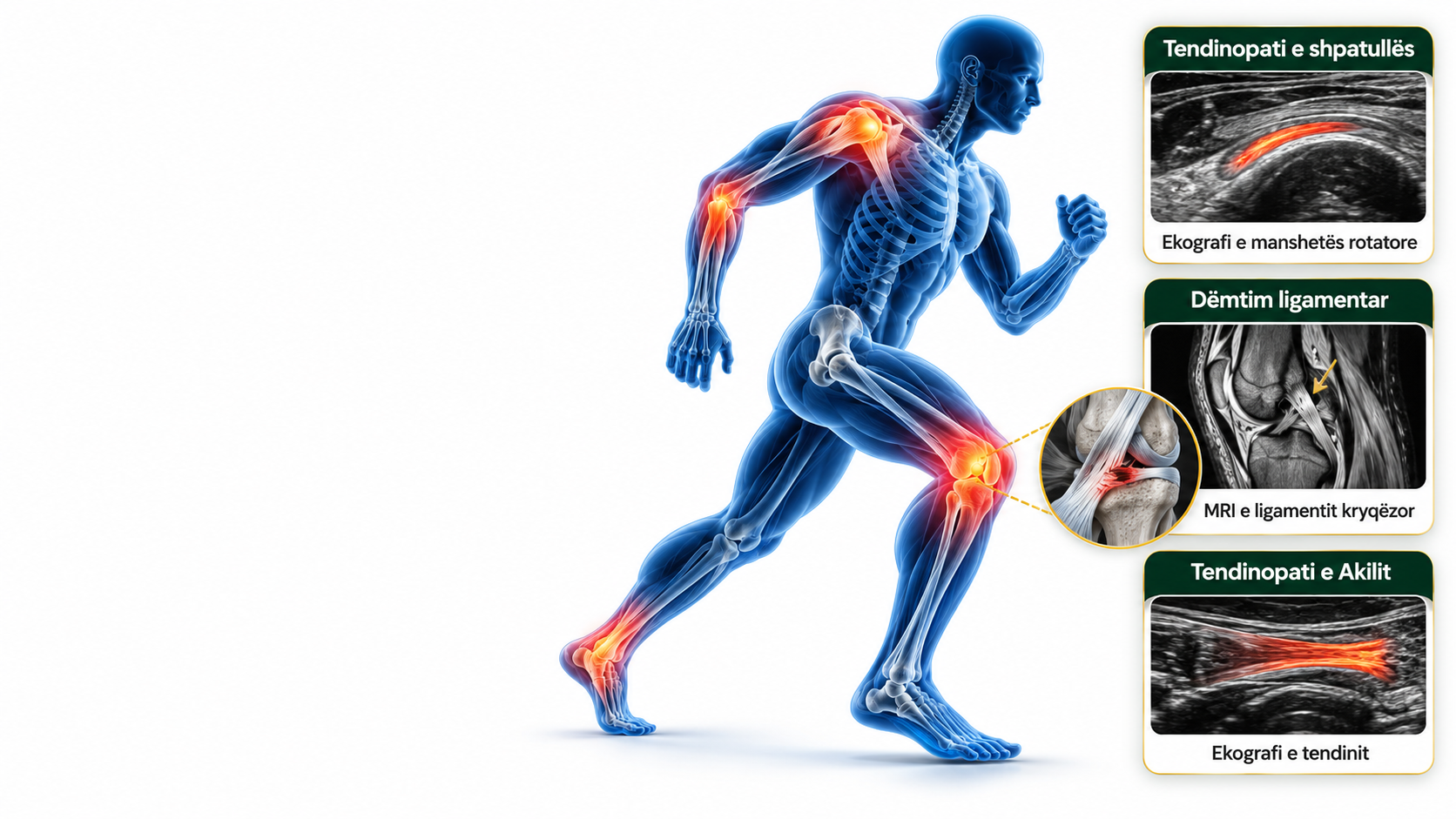 dhimbja nga tendinopatitë dhe dëmtimet ligamentare