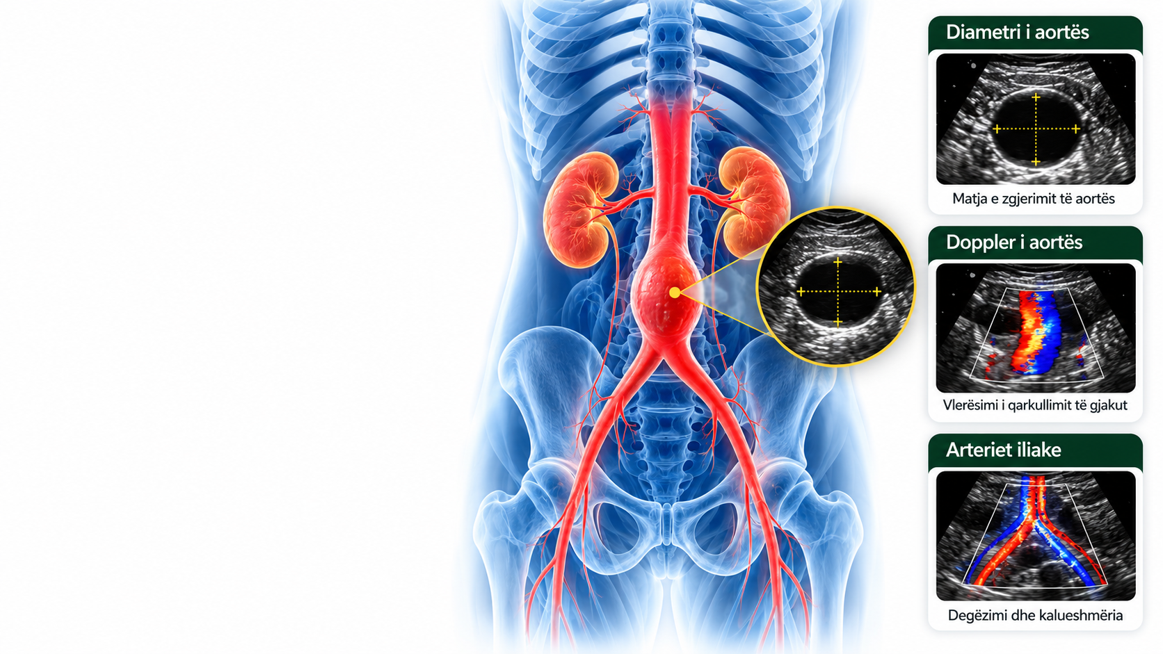 kontrolli i aortës abdominale