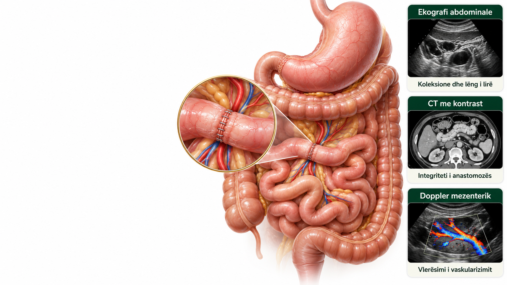 monitorimi pas kirurgjise gastrointestinale